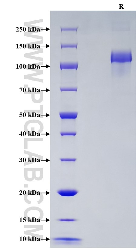 Purity of Recombinant Human  ACE2 was determined by SDS-PAGE. The protein was resolved in an SDS-PAGE in reducing (R) conditions and stained using Coomassie blue.