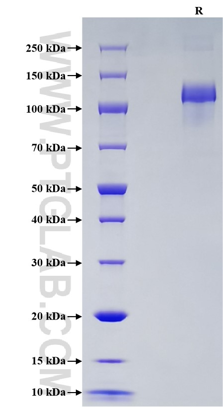 Purity of Recombinant Human ACE2 was determined by SDS-PAGE. The protein was resolved in an SDS-PAGE in reducing (R) conditions and stained using Coomassie blue. Purity of Recombinant Human ACE2 was determined by SDS-PAGE. The protein was resolved in an SDS-PAGE in reducing (R) conditions and stained using Coomassie blue.
