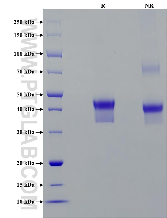 Purity of Recombinant Human CD2 was determined by SDS-PAGE. The protein was resolved in an SDS-PAGE in reducing (R) and non-reducing (NR) conditions and stained using Coomassie blue.