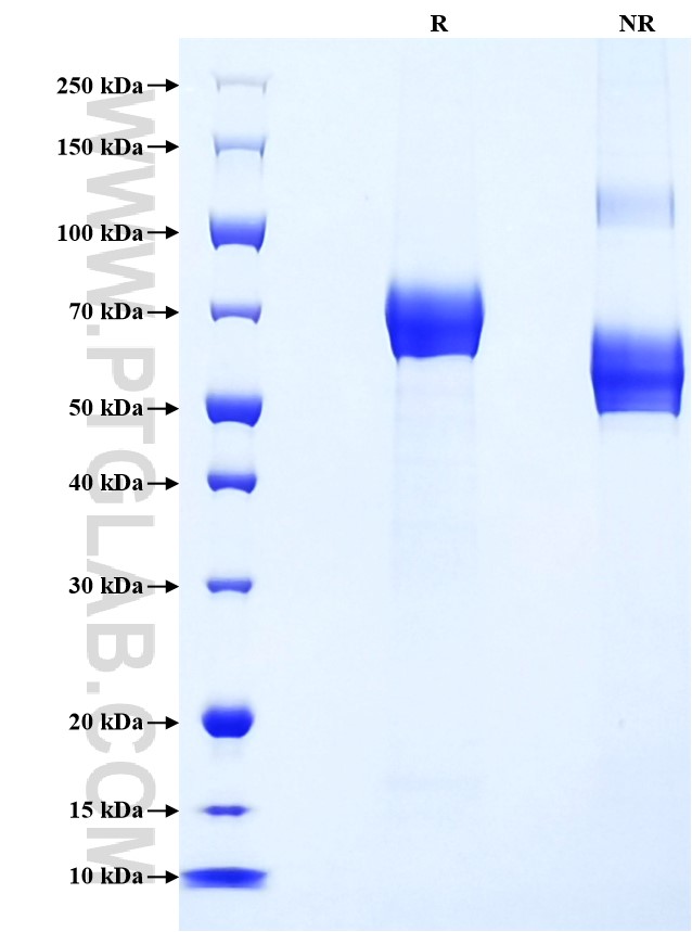 Purity of Recombinant Human EPHA2 was determined by SDS-PAGE. The protein was resolved in an SDS-PAGE in reducing (R) and non-reducing (NR) conditions and stained using Coomassie blue.
