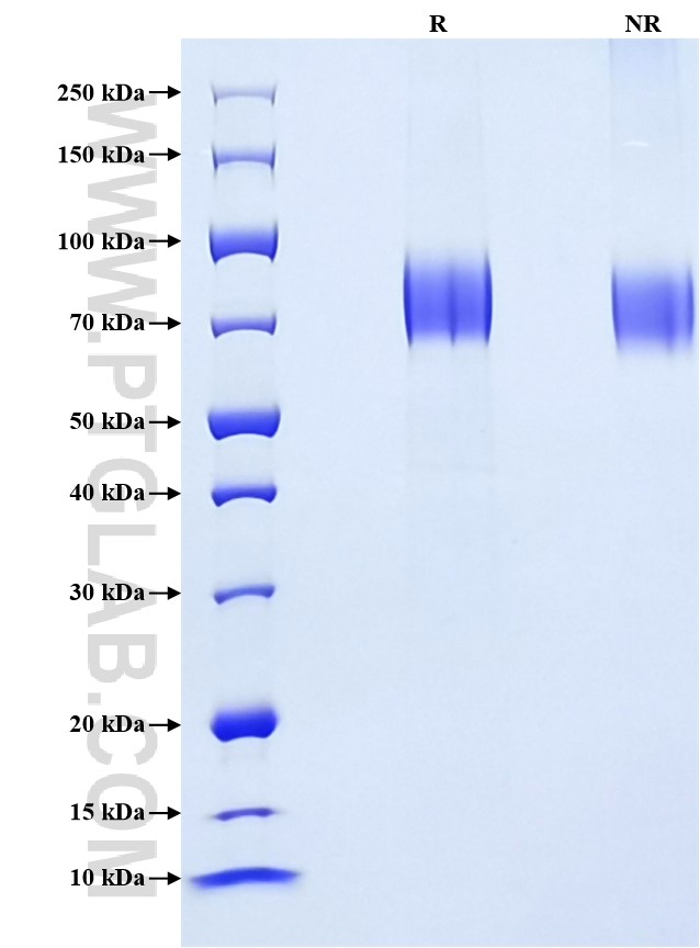 Purity of Recombinant Human IFNAR1 was determined by SDS-PAGE. The protein was resolved in an SDS-PAGE in reducing (R) and non-reducing (NR) conditions and stained using Coomassie blue.