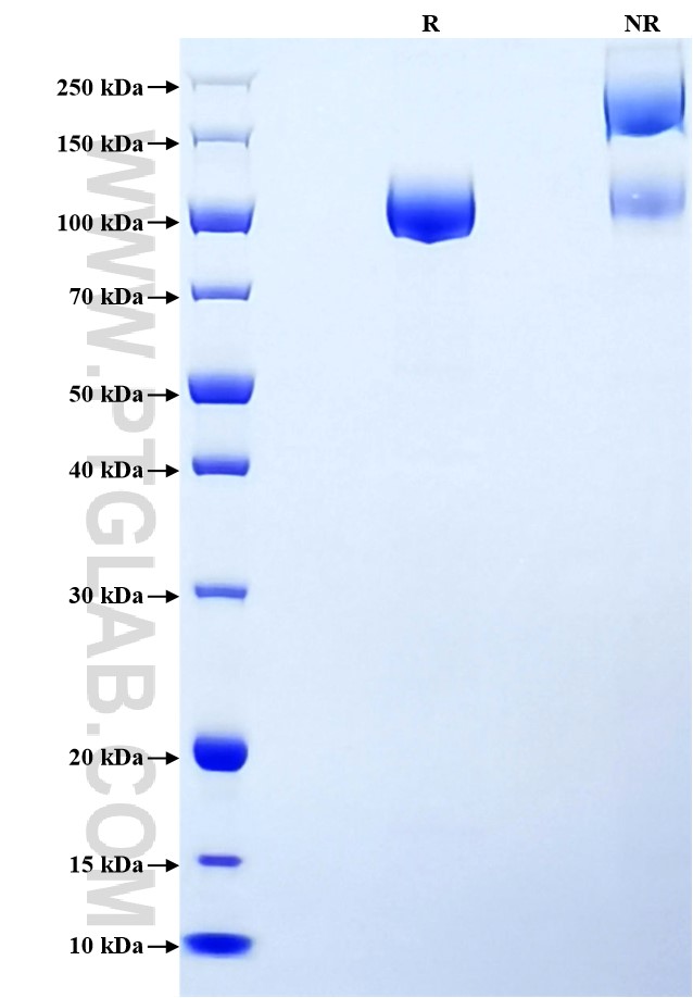 Purity of Recombinant Human DPP4 was determined by SDS-PAGE. The protein was resolved in an SDS-PAGE in reducing (R) and non-reducing (NR) conditions and stained using Coomassie blue.