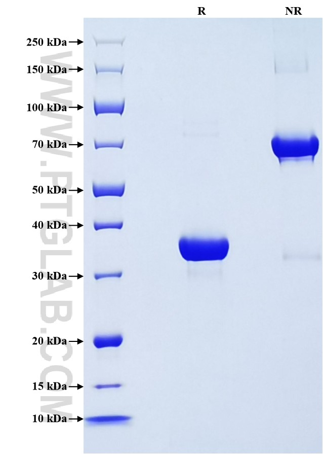 Purity of Recombinant Mouse CXCL1 was determined by SDS-PAGE. The protein was resolved in an SDS-PAGE in reducing (R) and non-reducing (NR) conditions and stained using Coomassie blue. Purity of Recombinant Mouse CXCL1 was determined by SDS-PAGE. The protein was resolved in an SDS-PAGE in reducing (R) and non-reducing (NR) conditions and stained using Coomassie blue.