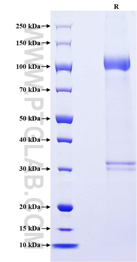 Purity of Recombinant Human FLT3 was determined by SDS-PAGE. The protein was resolved in an SDS-PAGE in reducing (R) conditions and stained using Coomassie blue.