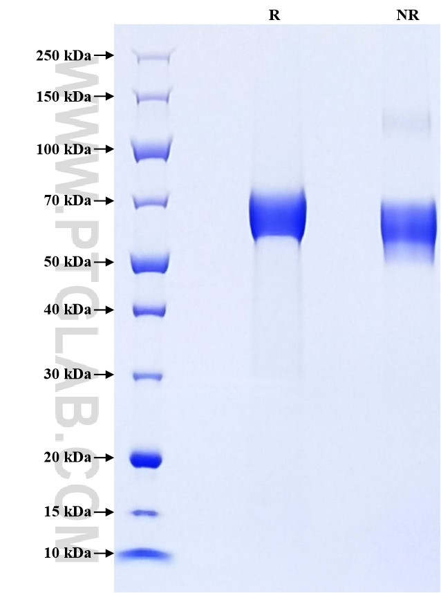 Purity of Recombinant Human t-Plasminogen Activator was determined by SDS-PAGE. The protein was resolved in an SDS-PAGE in reducing (R) and non-reducing (NR) conditions and stained using Coomassie blue.