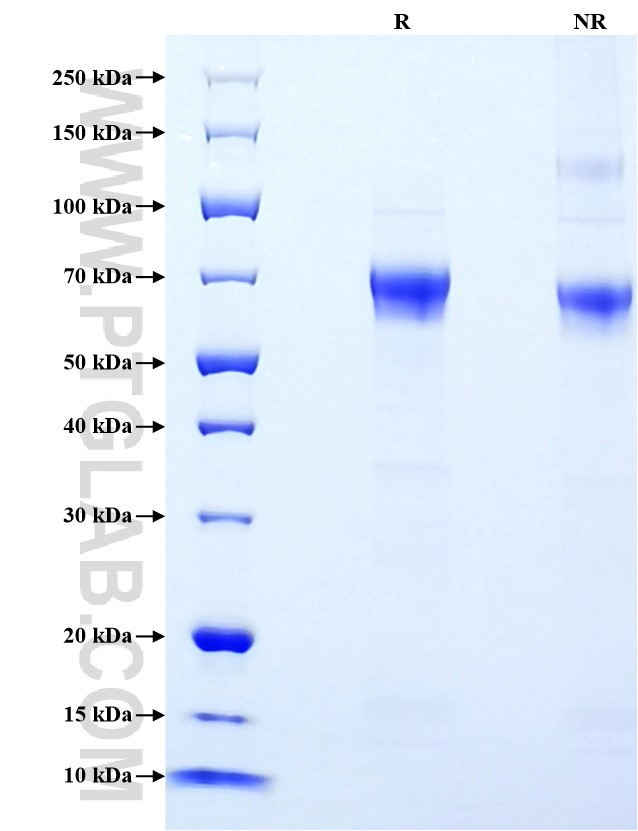 Purity of Recombinant Human FGFRL1 was determined by SDS-PAGE. The protein was resolved in an SDS-PAGE in reducing (R) and non-reducing (NR) conditions and stained using Coomassie blue.