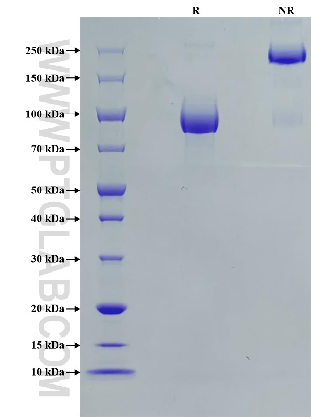 Purity of Recombinant Human FGFR2 (IIIc) was determined by SDS-PAGE. The protein was resolved in an SDS-PAGE in reducing (R) and non-reducing (NR) conditions and stained using Coomassie blue. Purity of Recombinant Human FGFR2 (IIIc) was determined by SDS-PAGE. The protein was resolved in an SDS-PAGE in reducing (R) and non-reducing (NR) conditions and stained using Coomassie blue.