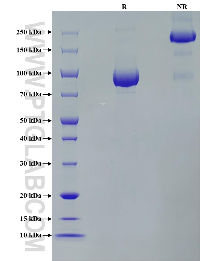 Purity of Recombinant Human FGFR3 (IIIb) was determined by SDS-PAGE. The protein was resolved in an SDS-PAGE in reducing (R) and non-reducing (NR) conditions and stained using Coomassie blue. Purity of Recombinant Human FGFR3 (IIIb) was determined by SDS-PAGE. The protein was resolved in an SDS-PAGE in reducing (R) and non-reducing (NR) conditions and stained using Coomassie blue.