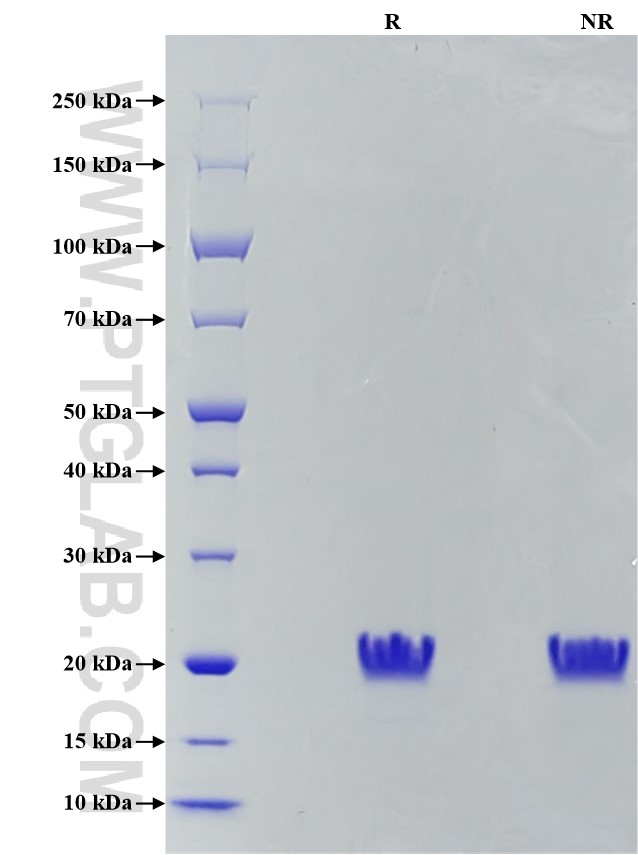 Purity of Recombinant Human CD20 was determined by SDS-PAGE. The protein was resolved in an SDS-PAGE in reducing (R) and non-reducing (NR) conditions and stained using Coomassie blue.