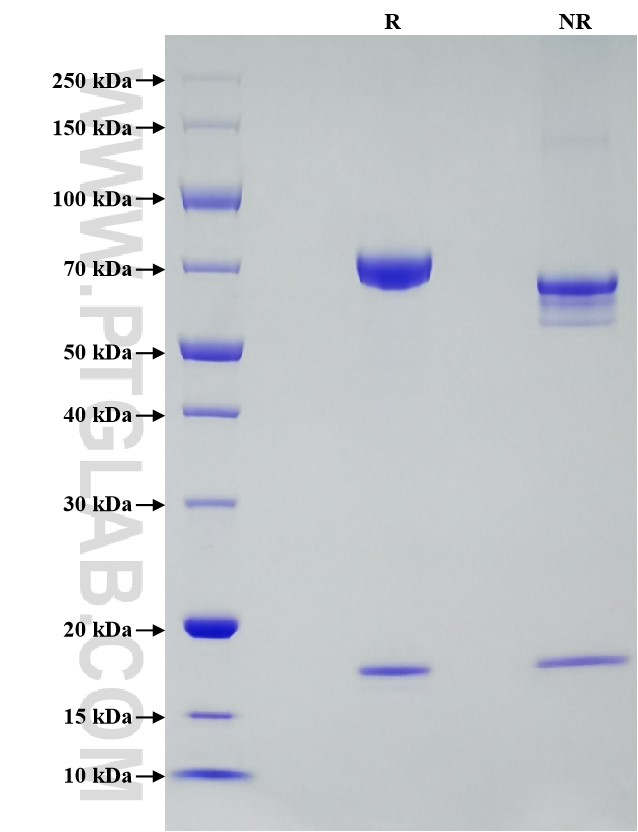 Purity of Recombinant Human PCSK9 was determined by SDS-PAGE. The protein was resolved in an SDS-PAGE in reducing (R) and non-reducing (NR) conditions and stained using Coomassie blue.