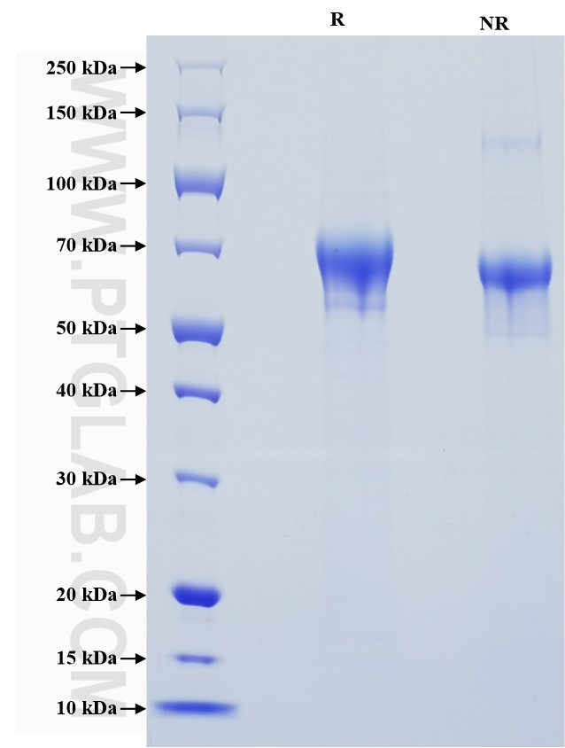 Purity of Recombinant Human ROR1 was determined by SDS-PAGE. The protein was resolved in an SDS-PAGE in reducing (R) and non-reducing (NR) conditions and stained using Coomassie blue.