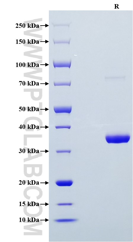 Purity of Recombinant Human IGF1 was determined by SDS-PAGE. The protein was resolved in an SDS-PAGE in reducing (R) conditions and stained using Coomassie blue. Purity of Recombinant Human IGF1 was determined by SDS-PAGE. The protein was resolved in an SDS-PAGE in reducing (R) conditions and stained using Coomassie blue.