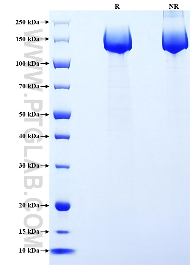 Purity of Recombinant Human L1CAM was determined by SDS-PAGE. The protein was resolved in an SDS-PAGE in reducing (R) and non-reducing (NR) conditions and stained using Coomassie blue.
