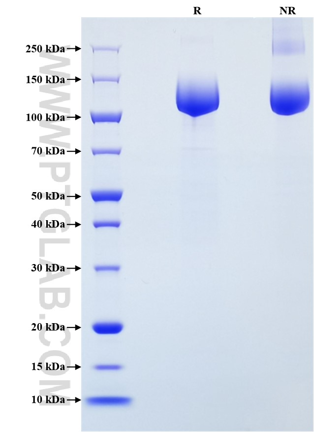 Purity of Recombinant Human VEGFR2 was determined by SDS-PAGE. The protein was resolved in an SDS-PAGE in reducing (R) and non-reducing (NR) conditions and stained using Coomassie blue.