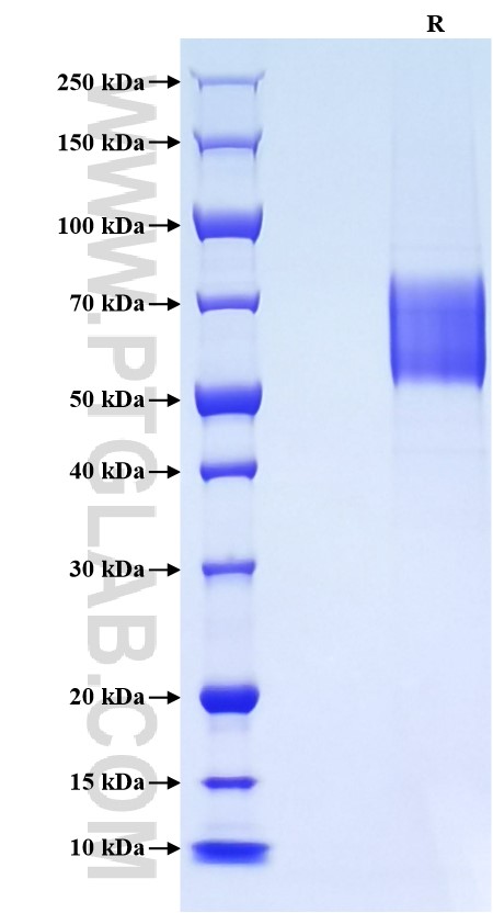 Purity of Recombinant Human FGFR4 was determined by SDS-PAGE. The protein was resolved in an SDS-PAGE in reducing (R) conditions and stained using Coomassie blue.
