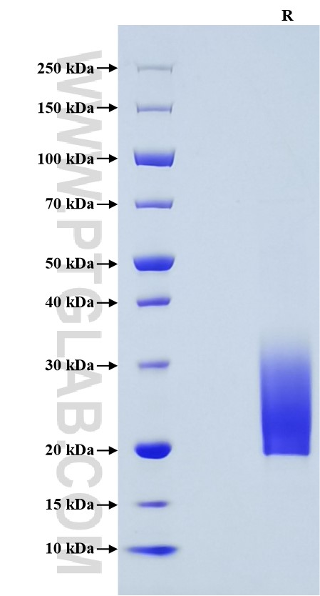 Purity of Recombinant Mouse IL-5 was determined by SDS-PAGE. The protein was resolved in an SDS-PAGE in reducing (R) conditions and stained using Coomassie blue. Purity of Recombinant Mouse IL-5 was determined by SDS-PAGE. The protein was resolved in an SDS-PAGE in reducing (R) conditions and stained using Coomassie blue.