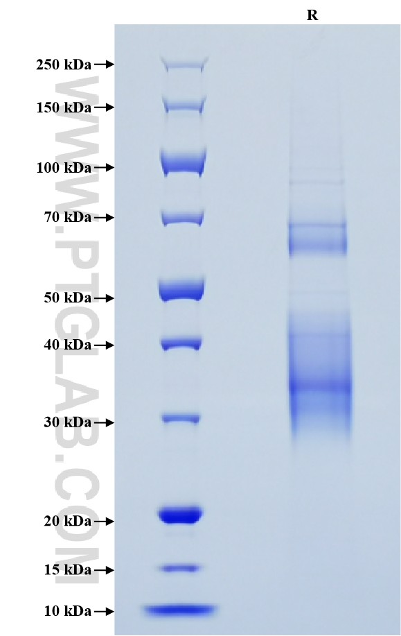 Purity of Recombinant Human CLU was determined by SDS-PAGE. The protein was resolved in an SDS-PAGE in reducing (R) conditions and stained using Coomassie blue.