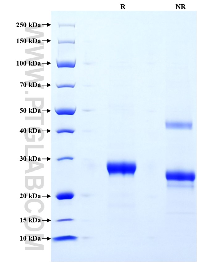 Purity of Recombinant Human COL18A1 was determined by SDS-PAGE. The protein was resolved in an SDS-PAGE in reducing (R) and non-reducing (NR) conditions and stained using Coomassie blue.