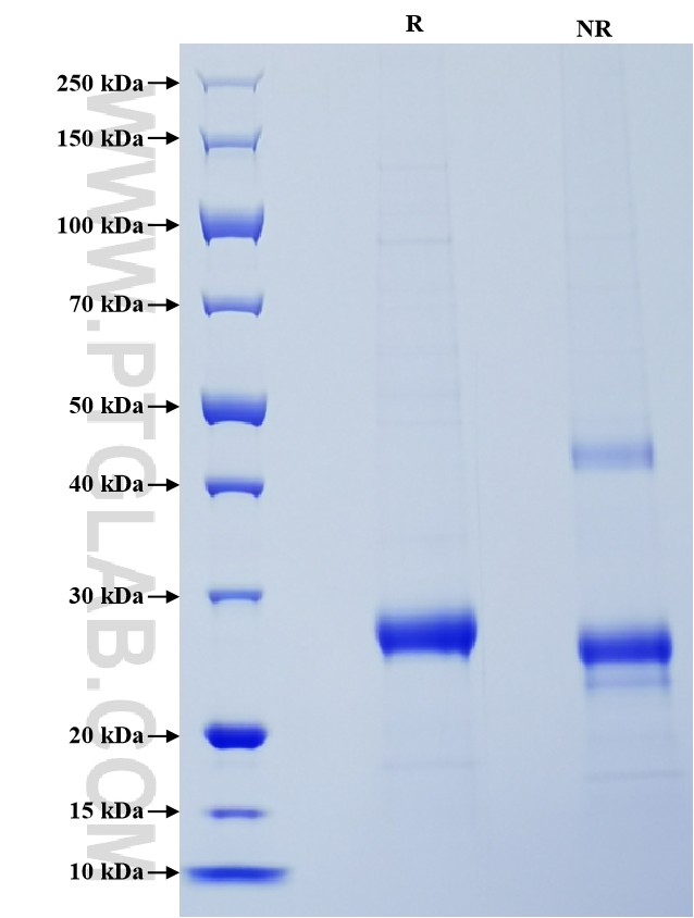 Purity of Recombinant Human COL18A1 was determined by SDS-PAGE. The protein was resolved in an SDS-PAGE in reducing (R) and non-reducing (NR) conditions and stained using Coomassie blue.