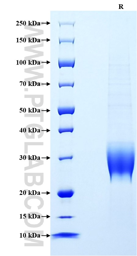 Purity of Recombinant Mouse G-CSF was determined by SDS-PAGE. The protein was resolved in an SDS-PAGE in reducing (R) conditions and stained using Coomassie blue.