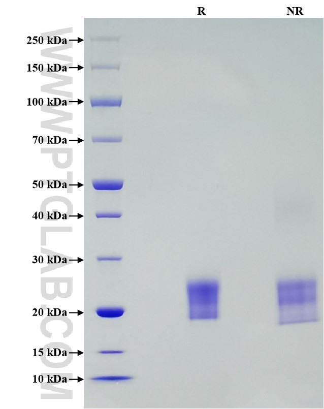 Purity of Recombinant Rat IL-2 was determined by SDS-PAGE. The protein was resolved in an SDS-PAGE in reducing (R) and non-reducing (NR) conditions and stained using Coomassie blue.