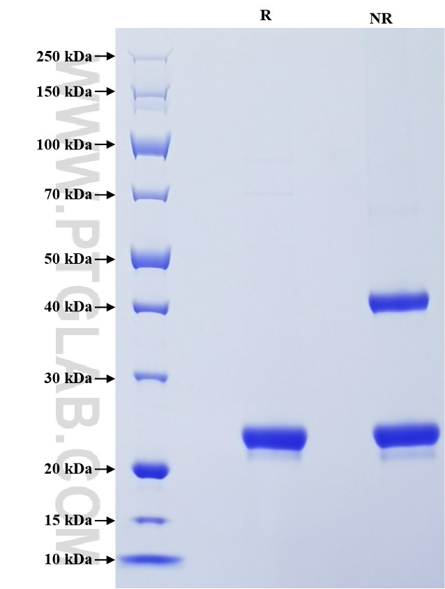 Purity of Recombinant Human NGAL was determined by SDS-PAGE. The protein was resolved in an SDS-PAGE in reducing (R) and non-reducing (NR) conditions and stained using Coomassie blue. Purity of Recombinant Human NGAL was determined by SDS-PAGE. The protein was resolved in an SDS-PAGE in reducing (R) and non-reducing (NR) conditions and stained using Coomassie blue.