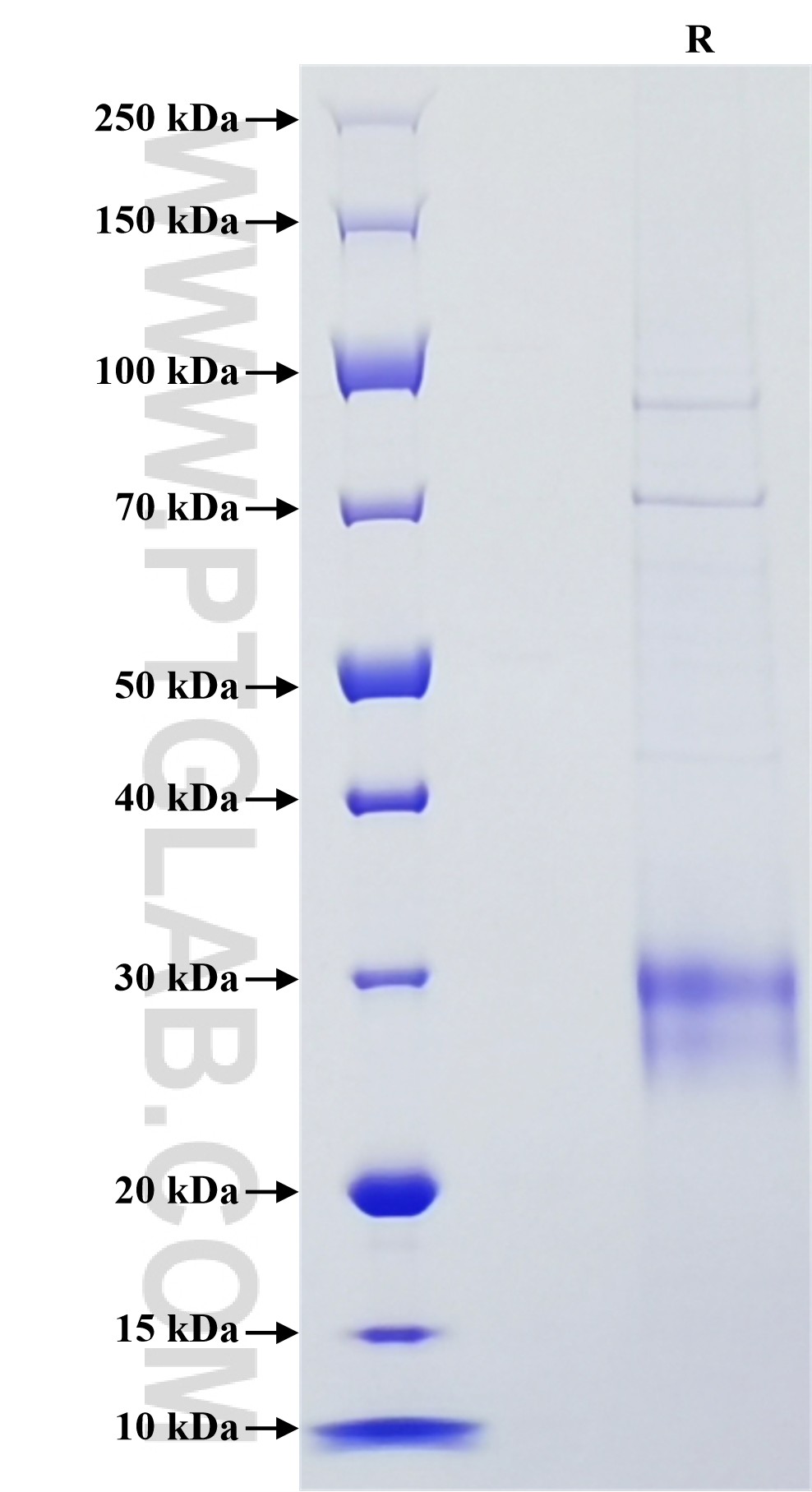 Purity of Recombinant Rat IL-10 was determined by SDS-PAGE. The protein was resolved in an SDS-PAGE in reducing (R) conditions and stained using Coomassie blue.