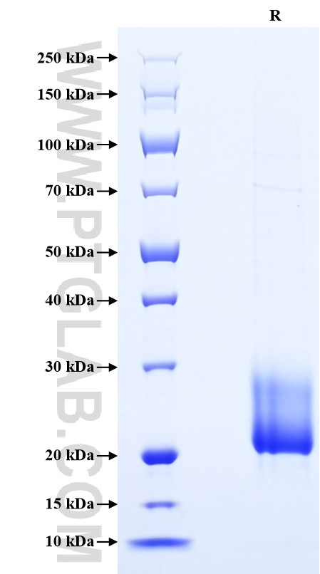 Purity of Recombinant Mouse VEGFD was determined by SDS-PAGE. The protein was resolved in an SDS-PAGE in reducing (R) conditions and stained using Coomassie blue. Purity of Recombinant Mouse VEGFD was determined by SDS-PAGE. The protein was resolved in an SDS-PAGE in reducing (R) conditions and stained using Coomassie blue.