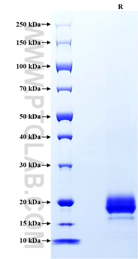 Purity of Recombinant Mouse VEGF120 was determined by SDS-PAGE. The protein was resolved in an SDS-PAGE in reducing (R) conditions and stained using Coomassie blue. Purity of Recombinant Mouse VEGF120 was determined by SDS-PAGE. The protein was resolved in an SDS-PAGE in reducing (R) conditions and stained using Coomassie blue.