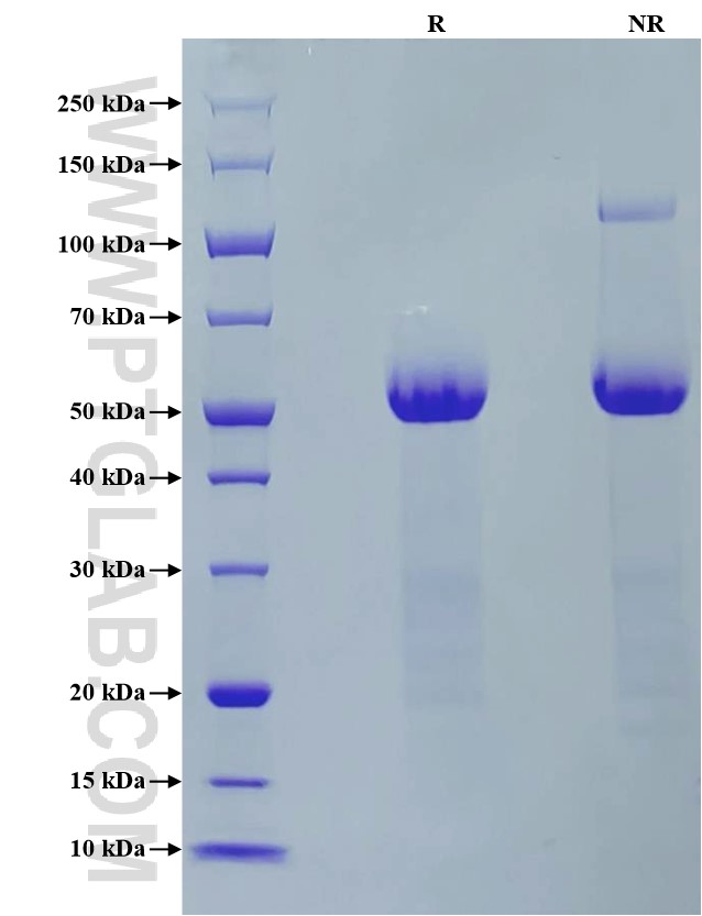 Purity of Recombinant Mouse Osteopontin was determined by SDS-PAGE. The protein was resolved in an SDS-PAGE in reducing (R) and non-reducing (NR) conditions and stained using Coomassie blue.