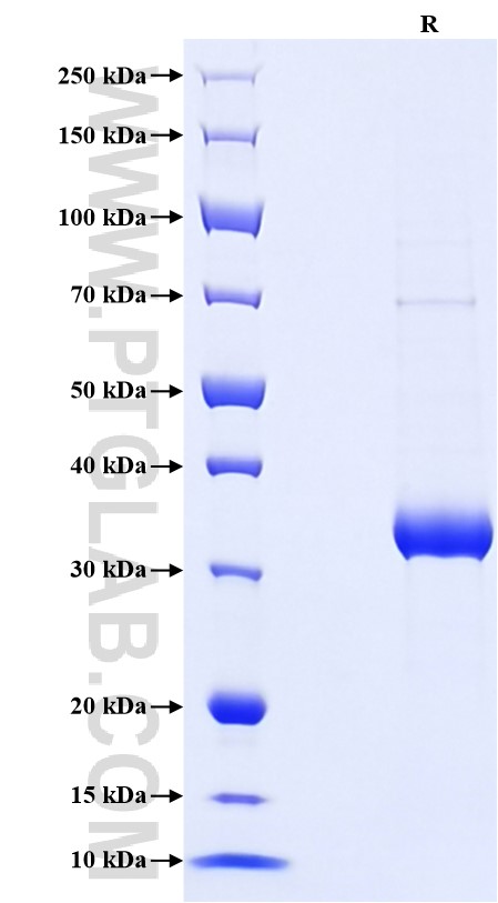 Purity of Recombinant Human INS was determined by SDS-PAGE. The protein was resolved in an SDS-PAGE in reducing (R) conditions and stained using Coomassie blue.