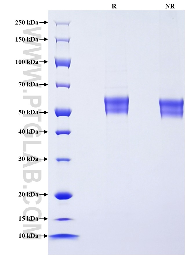 Purity of Recombinant Human CD4 was determined by SDS-PAGE. The protein was resolved in an SDS-PAGE in reducing (R) and non-reducing (NR) conditions and stained using Coomassie blue.