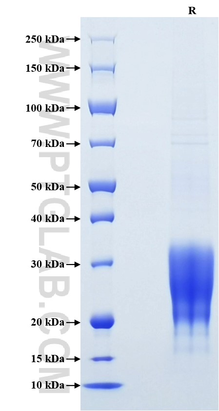 Purity of Recombinant Mouse IFN-gamma was determined by SDS-PAGE. The protein was resolved in an SDS-PAGE in reducing (R) conditions and stained using Coomassie blue.