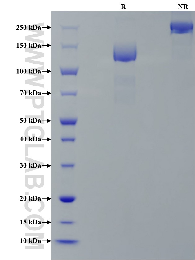 Purity of Recombinant Human VEGFR3 was determined by SDS-PAGE. The protein was resolved in an SDS-PAGE in reducing (R) and non-reducing (NR) conditions and stained using Coomassie blue. Purity of Recombinant Human VEGFR3 was determined by SDS-PAGE. The protein was resolved in an SDS-PAGE in reducing (R) and non-reducing (NR) conditions and stained using Coomassie blue.