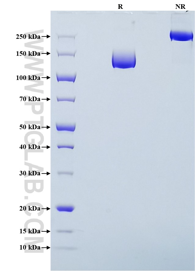 Purity of Recombinant Human VEGFR2 was determined by SDS-PAGE. The protein was resolved in an SDS-PAGE in reducing (R) and non-reducing (NR) conditions and stained using Coomassie blue. Purity of Recombinant Human VEGFR2 was determined by SDS-PAGE. The protein was resolved in an SDS-PAGE in reducing (R) and non-reducing (NR) conditions and stained using Coomassie blue.
