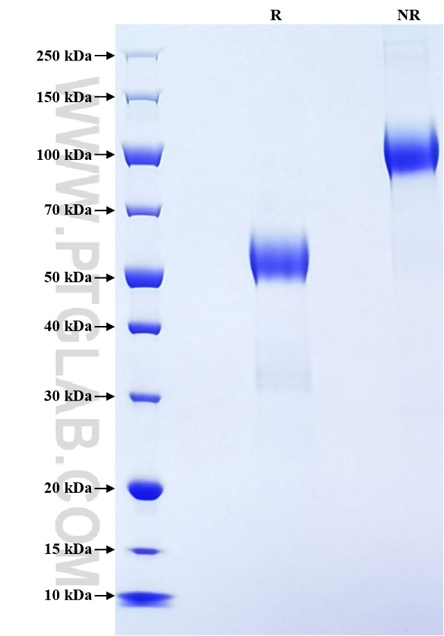 Purity of Recombinant Human CD70 was determined by SDS-PAGE. The protein was resolved in an SDS-PAGE in reducing (R) and non-reducing (NR) conditions and stained using Coomassie blue. Purity of Recombinant Human CD70 was determined by SDS-PAGE. The protein was resolved in an SDS-PAGE in reducing (R) and non-reducing (NR) conditions and stained using Coomassie blue.