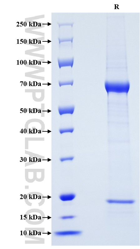 Purity of Recombinant Human PCSK9 was determined by SDS-PAGE. The protein was resolved in an SDS-PAGE in reducing (R) condition and stained using Coomassie blue.