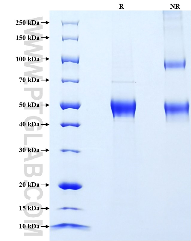 Purity of Recombinant Human SHBG was determined by SDS-PAGE. The protein was resolved in an SDS-PAGE in reducing (R) and non-reducing (NR) conditions and stained using Coomassie blue.