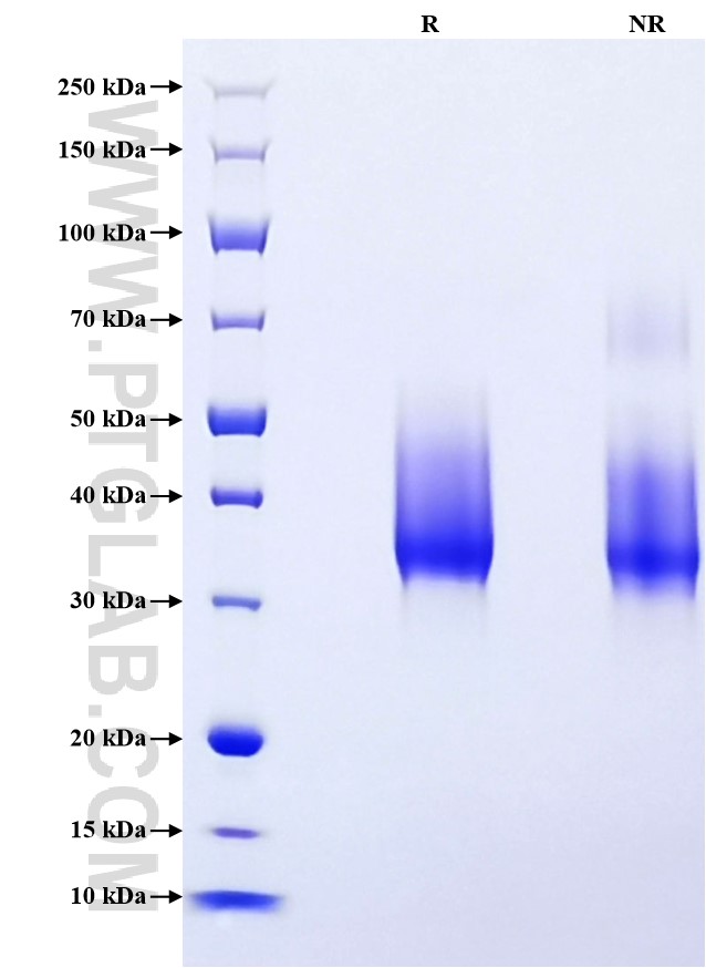 Purity of Recombinant Human ORM1 was determined by SDS-PAGE. The protein was resolved in an SDS-PAGE in reducing (R) and non-reducing (NR) conditions and stained using Coomassie blue.
