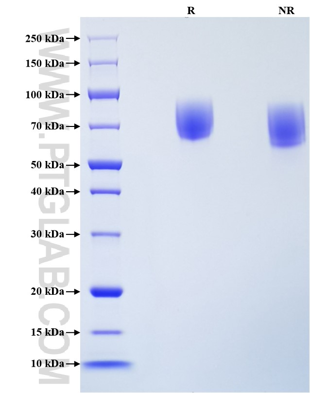 Purity of Recombinant Human MMP-8 was determined by SDS-PAGE. The protein was resolved in an SDS-PAGE in reducing (R) and non-reducing (NR) conditions and stained using Coomassie blue.