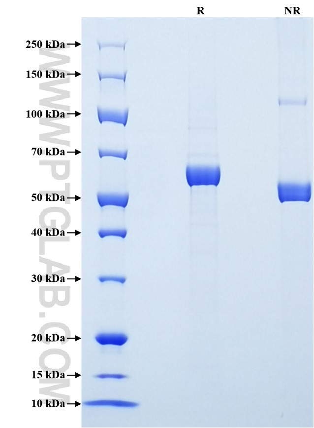 Purity of Recombinant Human MMP-3 was determined by SDS-PAGE. The protein was resolved in an SDS-PAGE in reducing (R) and non-reducing (NR) conditions and stained using Coomassie blue.