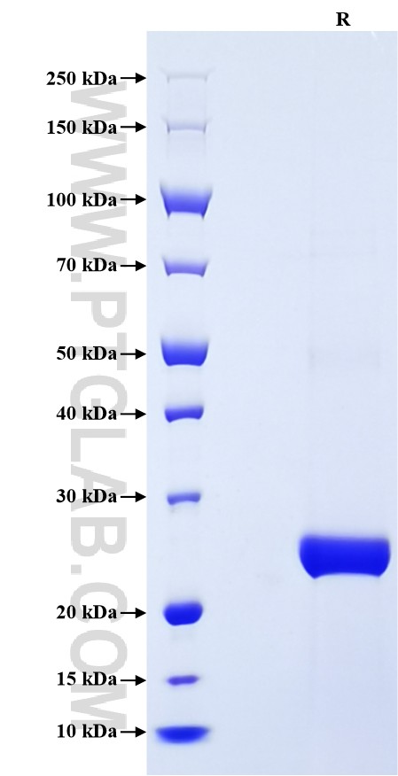 Purity of Recombinant Human TIMP2 was determined by SDS-PAGE. The protein was resolved in an SDS-PAGE in reducing (R) condition and stained using Coomassie blue.