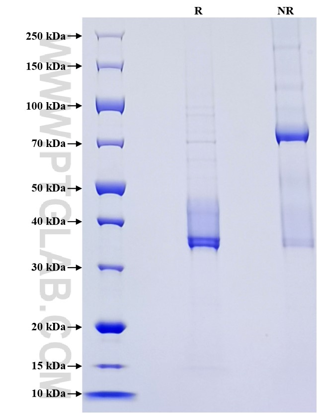 Purity of Recombinant Human APOE was determined by SDS-PAGE. The protein was resolved in an SDS-PAGE in reducing (R) and non-reducing (NR) conditions and stained using Coomassie blue.