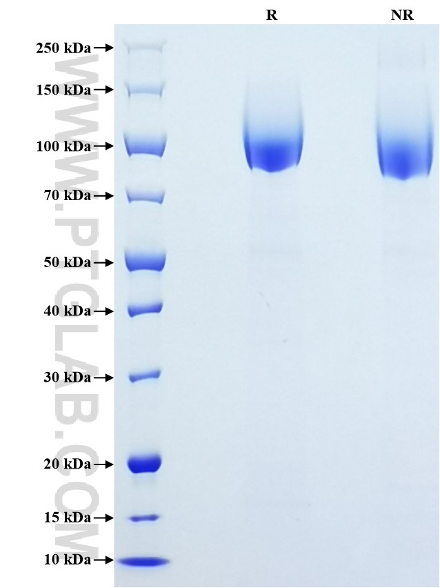 Purity of Recombinant Human CEA was determined by SDS-PAGE. The protein was resolved in an SDS-PAGE in reducing (R) and non-reducing (NR) conditions and stained using Coomassie blue.