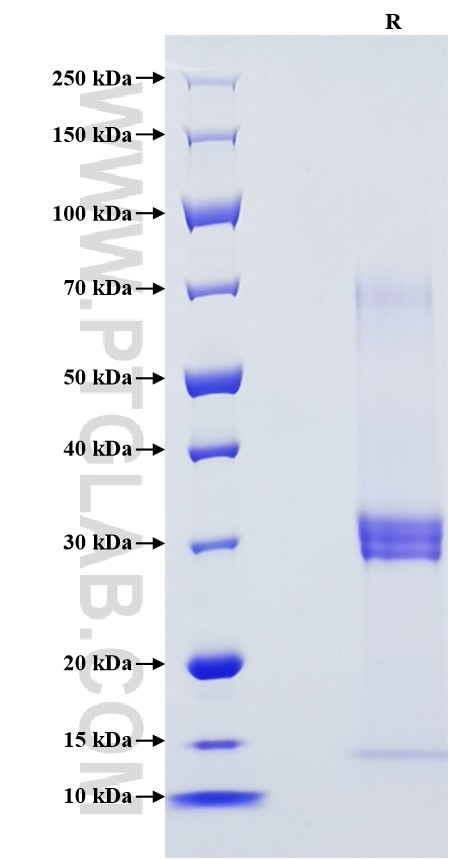 Purity of Recombinant Human IL-18BP was determined by SDS-PAGE. The protein was resolved in an SDS-PAGE in reducing (R) conditions and stained using Coomassie blue.