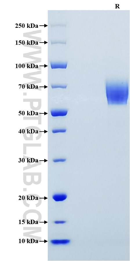 Purity of Recombinant Human IL-6R alpha was determined by SDS-PAGE. The protein was resolved in an SDS-PAGE in reducing (R) conditions and stained using Coomassie blue.