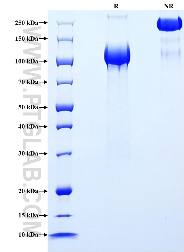 Purity of Recombinant Human EGFR was determined by SDS-PAGE. The protein was resolved in an SDS-PAGE in reducing (R) and non-reducing (NR) conditions and stained using Coomassie blue. Purity of Recombinant Human EGFR was determined by SDS-PAGE. The protein was resolved in an SDS-PAGE in reducing (R) and non-reducing (NR) conditions and stained using Coomassie blue.