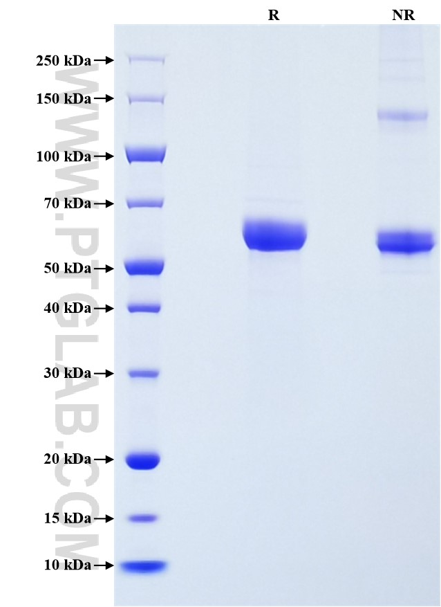 Purity of Recombinant Human MMP-1 was determined by SDS-PAGE. The protein was resolved in an SDS-PAGE in reducing (R) and non-reducing (NR) conditions and stained using Coomassie blue.
