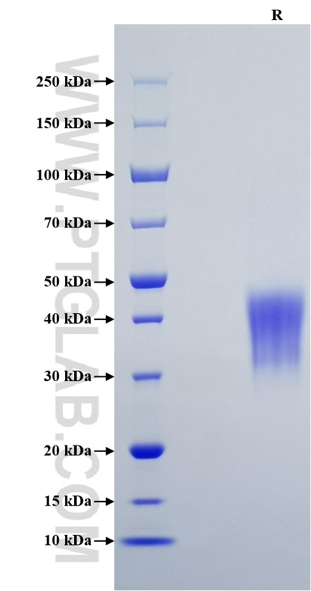 Purity of Recombinant Human TNFR1 was determined by SDS-PAGE. The protein was resolved in an SDS-PAGE in reducing (R) conditions and stained using Coomassie blue.