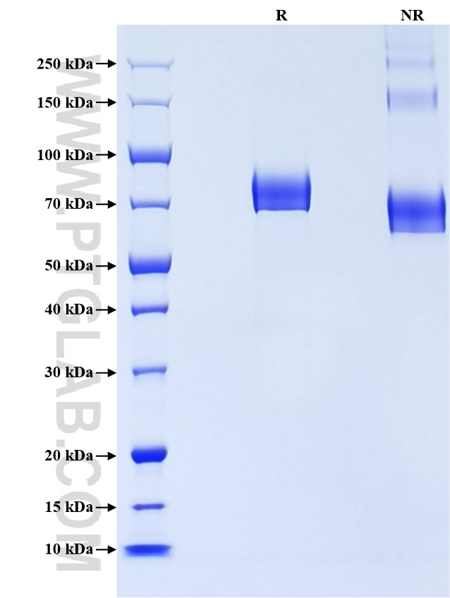 Purity of Recombinant Human ECM1 was determined by SDS-PAGE. The protein was resolved in an SDS-PAGE in reducing (R) and non-reducing (NR) conditions and stained using Coomassie blue.